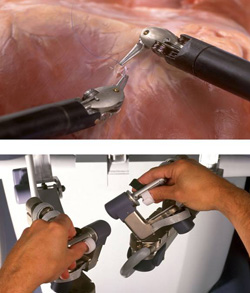 Da Vinci Surgical System